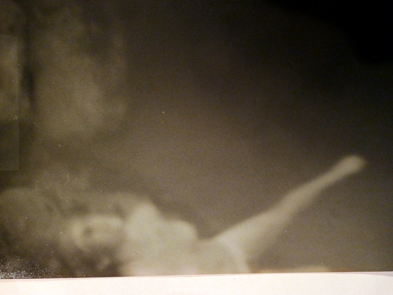 the body without organs