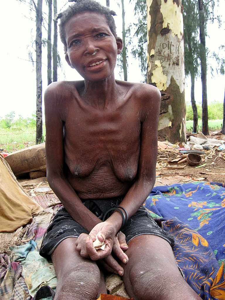 How cruel to face death ,to be robbed of a life of promise